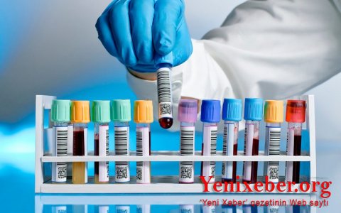 В Азербайджане коронавирусом заразились еще 19 человек