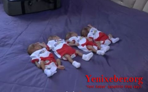 TƏBİB: Из родившихся в Баку пятерняшек состояние двоих крайне тяжелое, троих – стабильно тяжелое