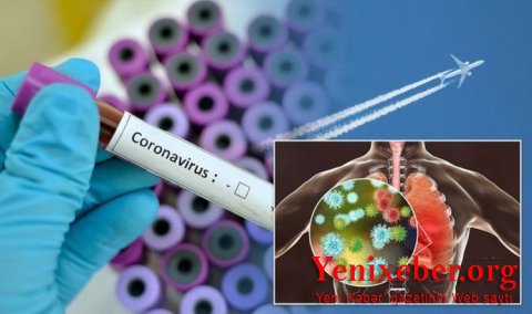 Pandemiyadan doğan zərurətlər