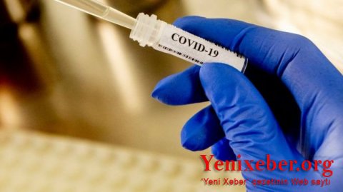 Azərbaycanda koronavirus testini harada verə bilərəm? -