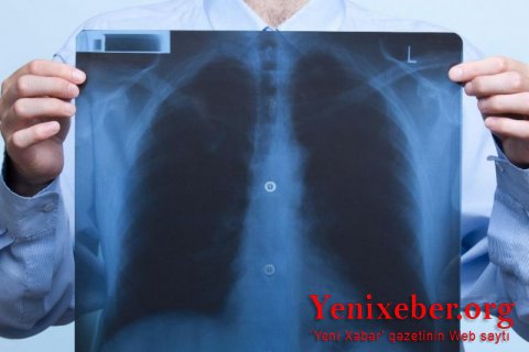 TƏBİB-in fəaliyyətinin uğursuzluğu və xalqın bu quruma inamsızlığının səbəbi