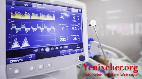 Süni tənəffüs cihazında olan xəstələrin sayı-