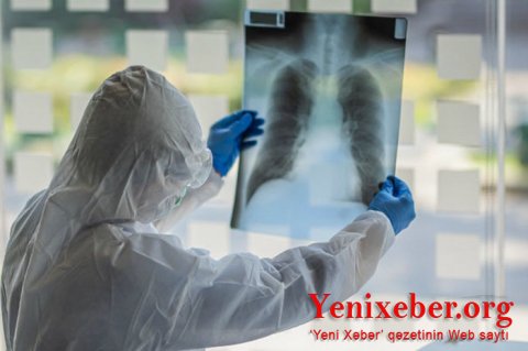 Koronavirusa yoluxanların sayı 12 milyonu ötdü-