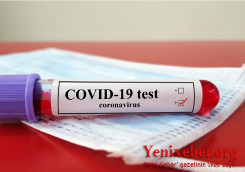 COVID-19-dan ölənlərin sayı 737 mini keçdi-