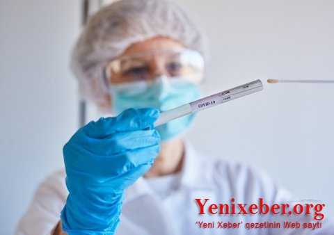 COVID-19-a 286 min yeni yoluxma aşkarlanıb-
