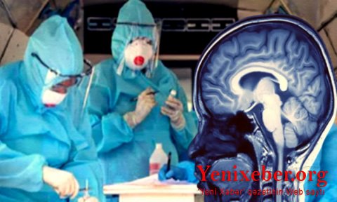 Koronavirus beyini zədələyirmiş-