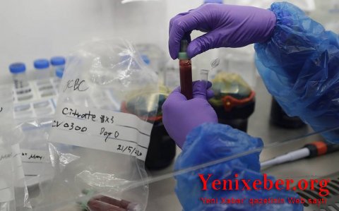 Azərbaycanda 2 259 nəfər koronavirusa yoluxub-