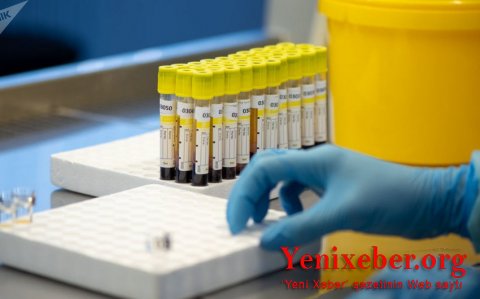 Ermənistanda COVID-19-la bağlı son durum belədir