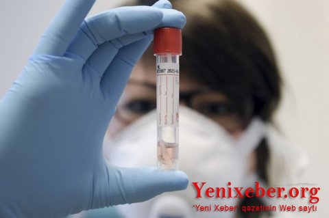 Koronavirus qurbanlarının sayı 1,7 milyonu ötüb-