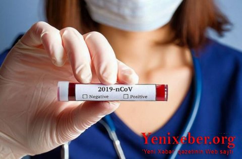 Azərbaycanda 1101 nəfər koronavirusa yoluxub-