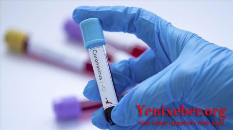 Koronavirusa yoluxanların sayı 86 milyonu keçdi-