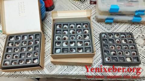 İsraildən Azərbaycana 300-dən artıq protez göz gətirilib-