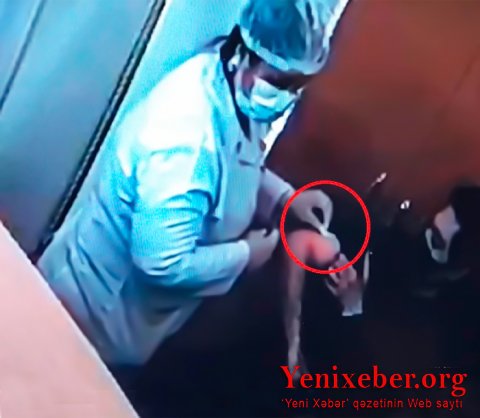 14 nömrəli xəstəxanada peyvənd oyunu - GÖRÜNTÜLƏR YAYILDI -