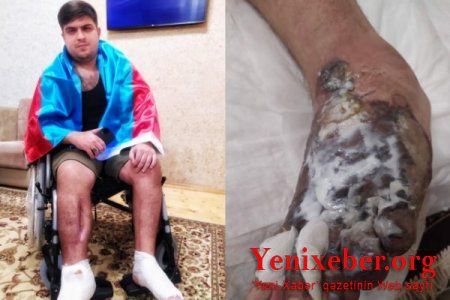 "HB Güvən" klinikasının professoru qazinin ayağını görün nə hala saldı -