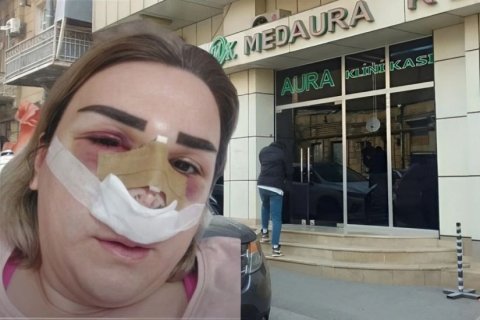 Həkimin yanlış əməliyyatı pasiyentin səhhətində problemlər yaratdı –