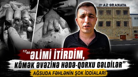 “Əlimi itirdim, kömək əvəzinə hədə-qorxu gəldilər” – Ağsu sakininin Azərqranata MMC ilə bağlı şikayəti
